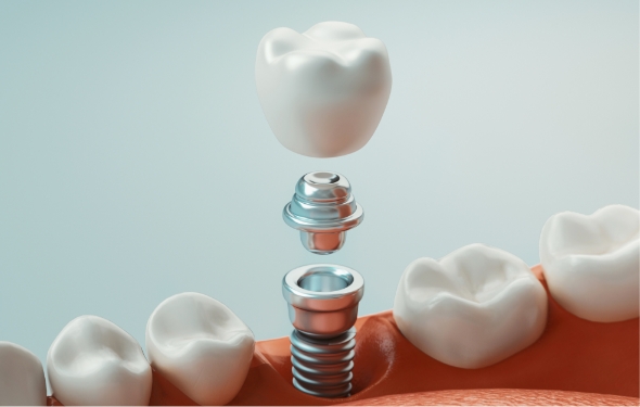 Woman receiving dental checkup