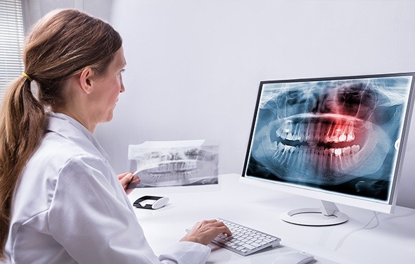 Digital dental x-rays on computer screen